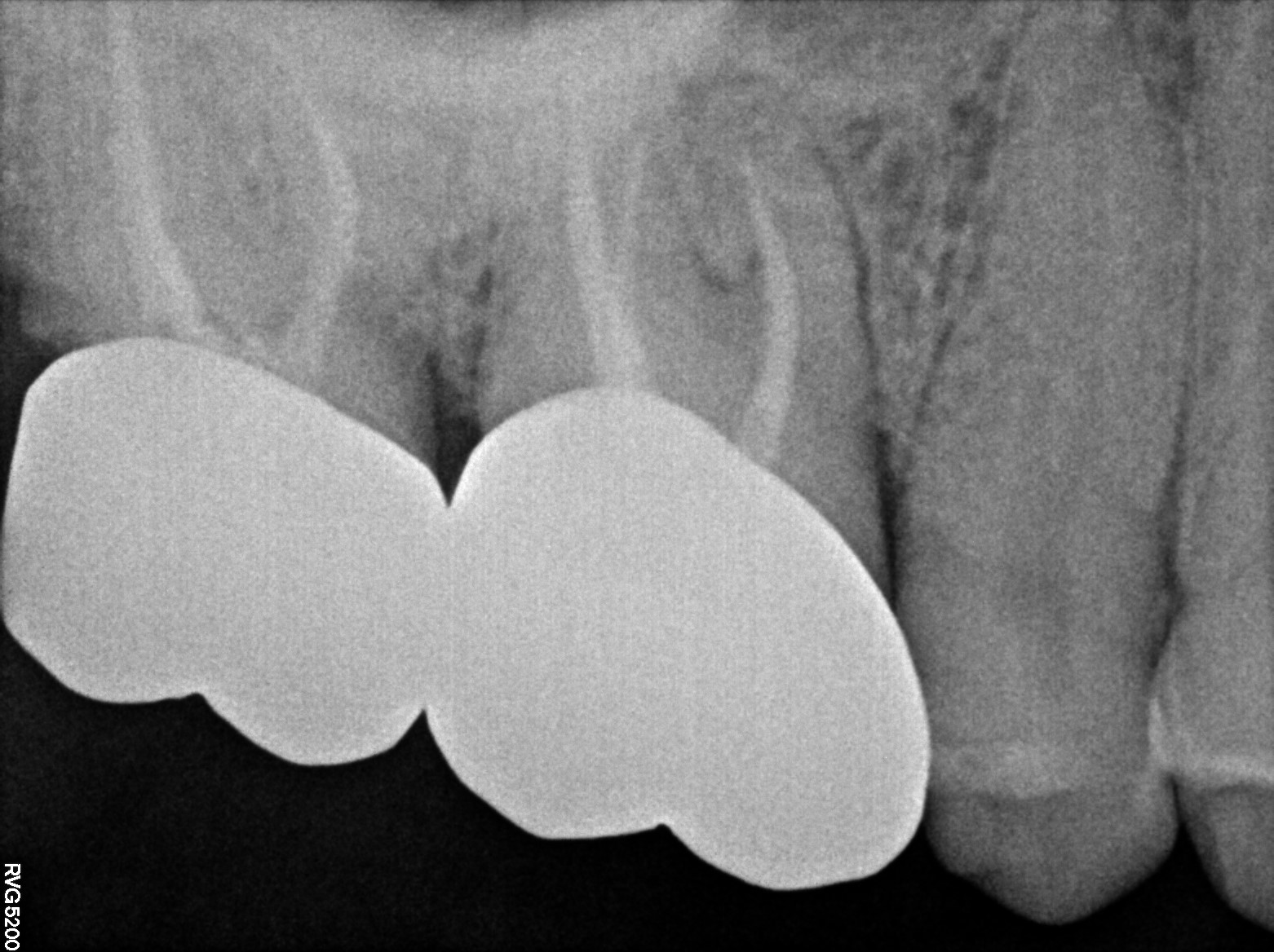 Dental X-ray